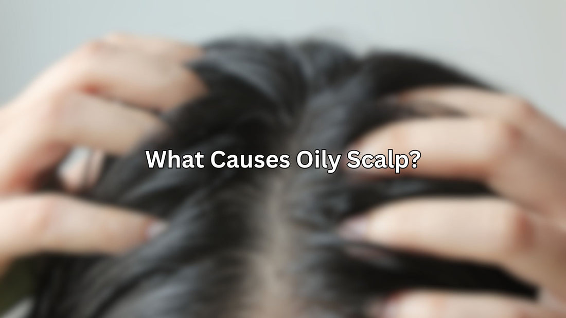 What Causes Oily Scalp | 6 Causes Of Greasy Scalp And Their Remedies